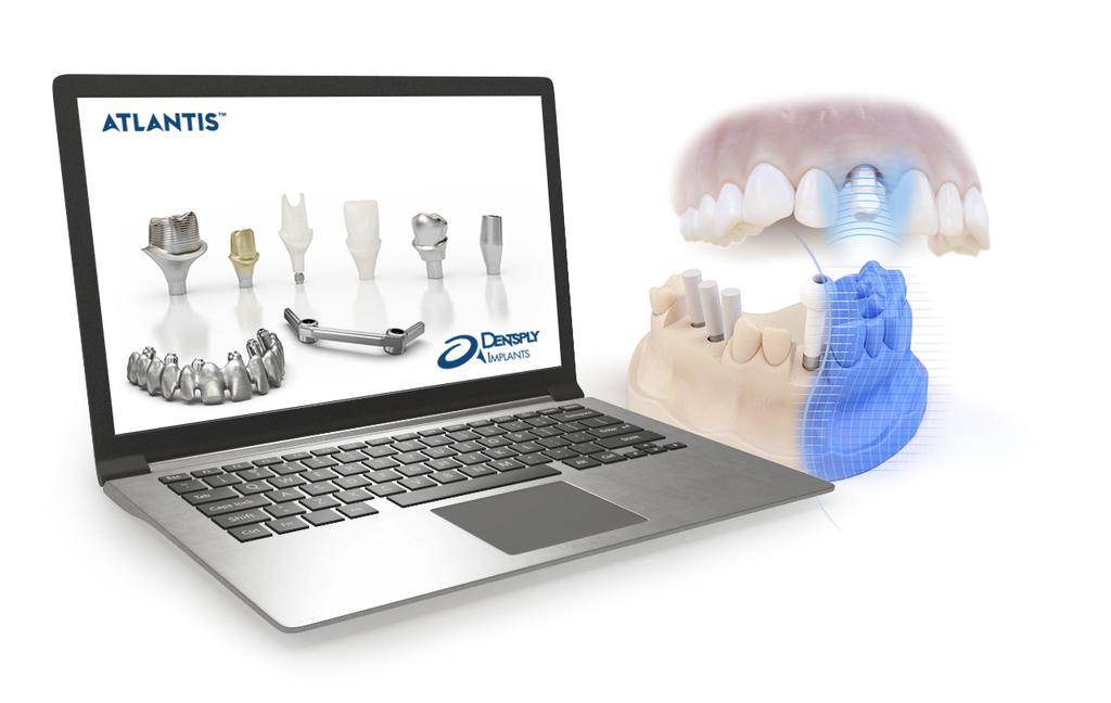 Intraoral scanning for ATLANTIS abutments - utilizing ATLANTIS Scan Upload 1.6 ATLANTIS Scan Upload 1.