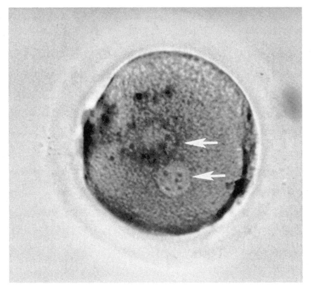 Extrusion of the second polar body from activated oocytes was seen approximately 6 hours following injection of the spermatozoon.