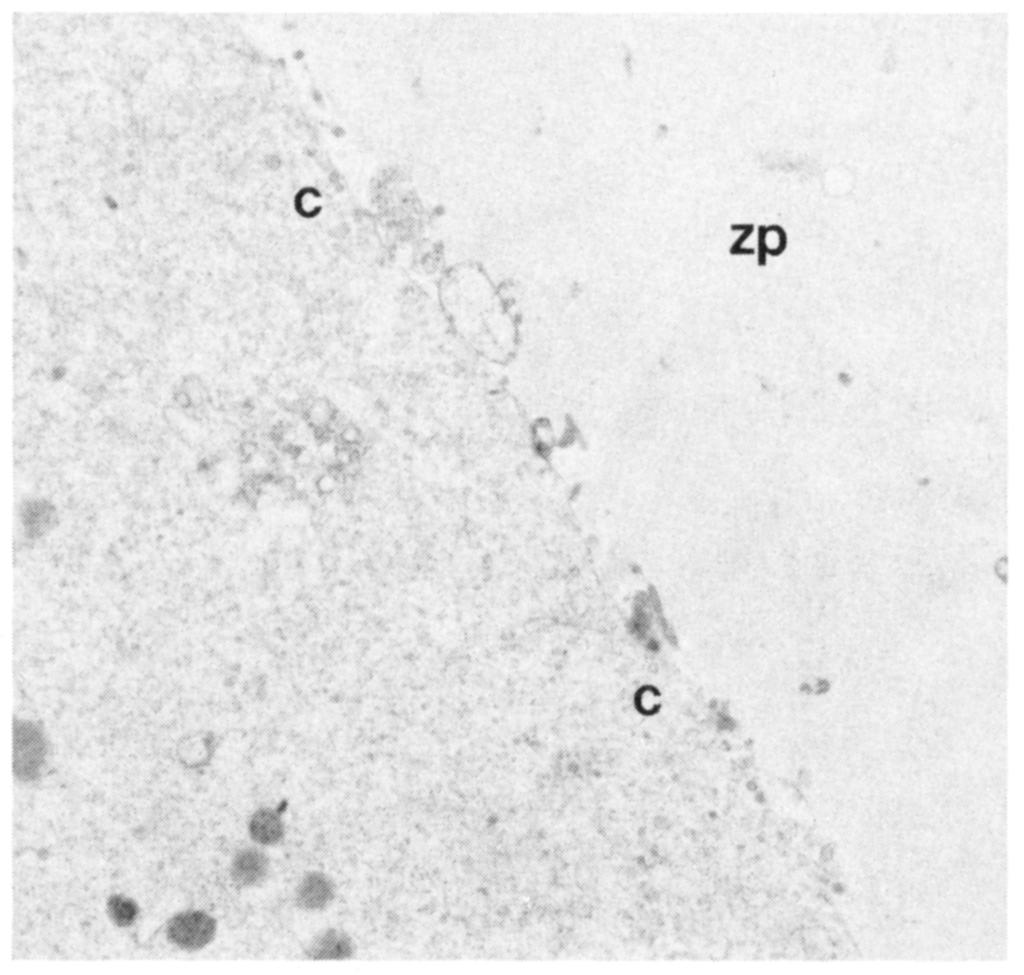 Sites of degeneration were observed within the cytoplasm of one injected oocyte as demonstrated by the presence of large lysosomal vacuoles lying within the vicinity of the two pronuclei.
