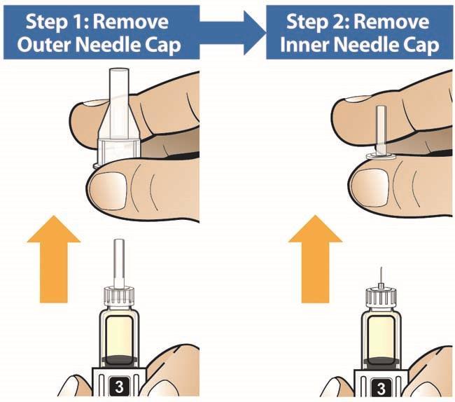 STEP C Remove Both Needle Caps and Inject Your Medicine Remove Needle Caps Carefully remove the outer needle cap, then the inner needle cap.