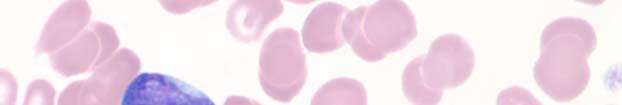 2 Platelet count (10 9 /L) 533 Slide 020 was prepared from the peripheral blood obtained from a 46 year-old male with a