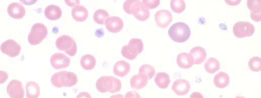 There were very few participants that identified lymphoblast (3 participants), monoblast (2 participants), lymphoma cell (1
