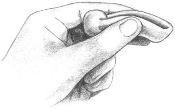 1. Wear dry gloves. When necessary, lubricate the entering end of the pessary. Hold the pessary as shown in Figure 1. Compress the pessary (bringing sides together) as shown in Figure 1. 2.