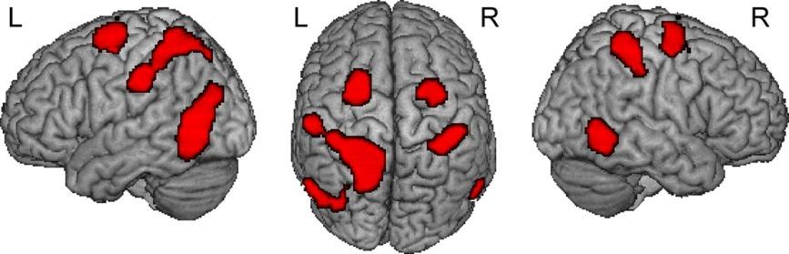 The mental representation of movement is assumed to involve various cortical areas posterior