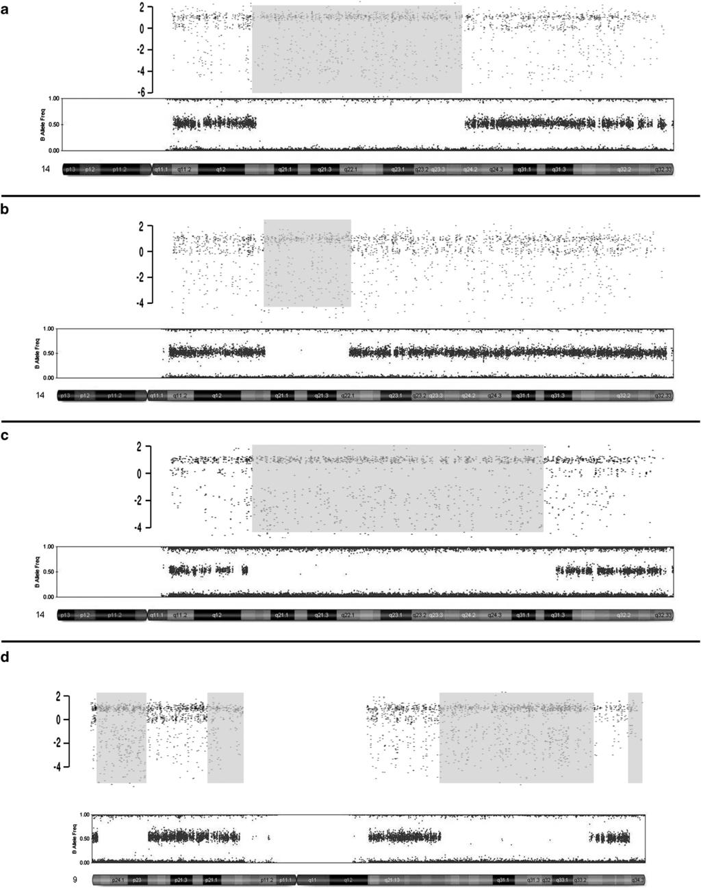 82 Figure 1 Large regions of AOH limited to single chromosomes suggestive of heterodisomy. Top panels CMA-COMP SNP data. Bottom panels corresponding Illumina B allele frequency data.