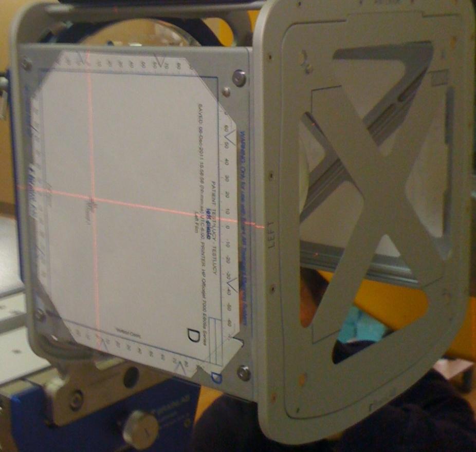 localizer frame. Figure 10 shows positioning of the Lucy phantom with the head localizer frame and TaPo overlay.