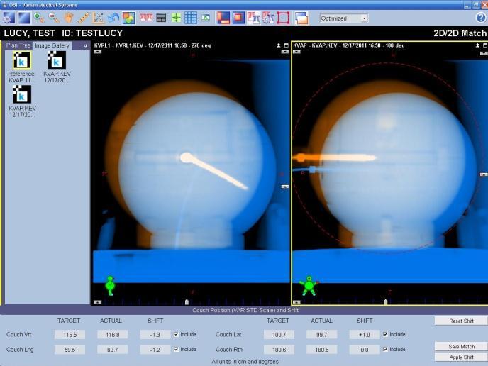 Figure 11: On-Board Imaging portal allows medical physicists the ability to image phantom on the