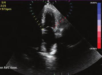 Khandheria, MD, FASE Case-based Approach to Clinical Echocardiography