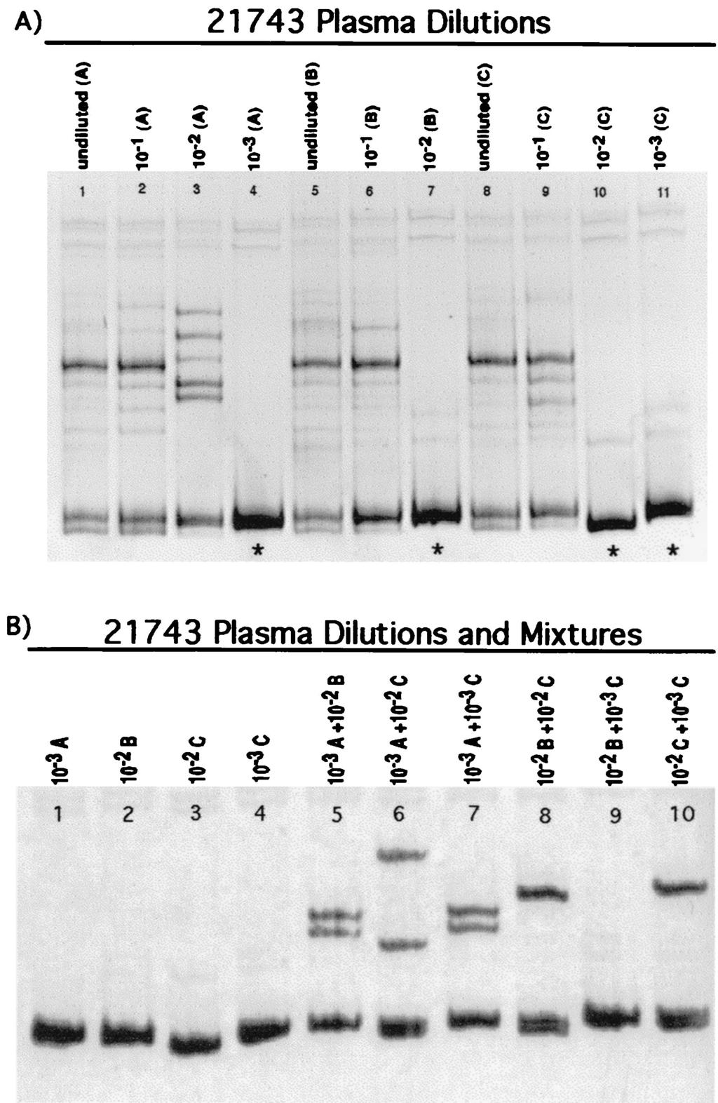 VOL. 75, 2001 TRANSMISSION OF SIV VARIANTS 3761 FIG. 10. SIV V1-V2 variants present in dilution series B (Fig. 9) of plasma from donor monkey 21743 at 2 weeks p.i. Lanes 1 to 3, dilutions of plasma from undiluted to 10 2 (same as lanes 5 to 7 in Fig.