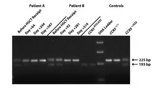 CCR5 genotype pre- and post-hsct Henrich et al J Infect Dis