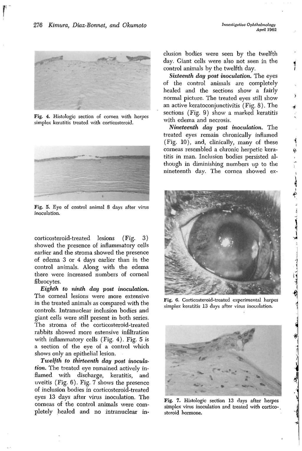 276 Kimura, Diaz-Bonnet, and Okumoto Fig. 4. Histologic section of cornea with herpes simplex keratitis treated with corticosterokl.