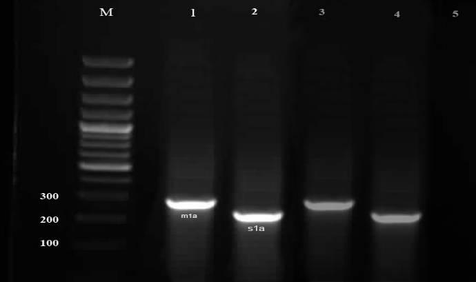 Figure 3: Lentification of m1b and s2 genotypes of the Helicobacter pylori strains of food samples by gel electrophoresis.