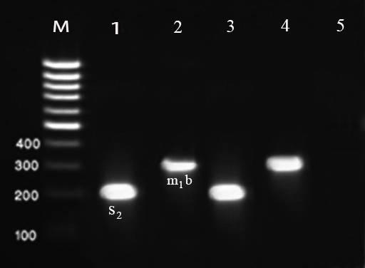 isolated from ready to eat foods Figure 1: Results of the gel electrophoresis for the identification of m2, s1b and s1c genotypes of the Helicobacter pylori strains of food samples.