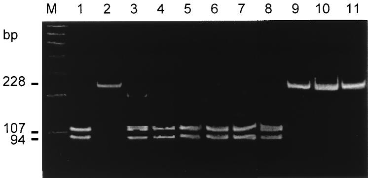 946 RUDI ET AL. J. CLIN. MICROBIOL. FIG. 1. PAGE after PCR amplification of H. pylori DNA using primers vac1f-vac1r and NlaIII digestion.