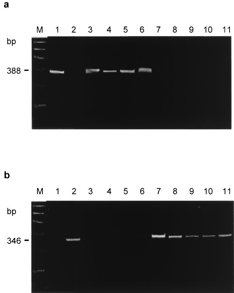 pylori 60190 (vaca genotype s1); 2, Tx30a (vaca genotype s2); 3 to 8, type s1 isolates; 9 to 11, type s2 isolates.