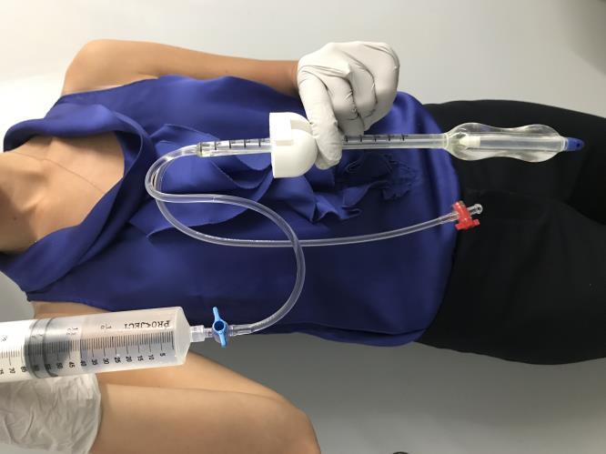 Figure 3. Proper Positioning for Device Preparation CAUTION: Allow vacuum to draw fluid into the device. Do not actively depress the syringe plunger to inject fluid into the balloon.
