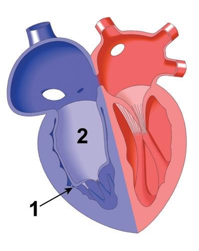 Inlet portion of the RV integrated into the right atrium (Number 2 illustrates the RA with the integrated inlet portion of the RV) Functional RV Trabecular and outlet portions of the RV Small RV