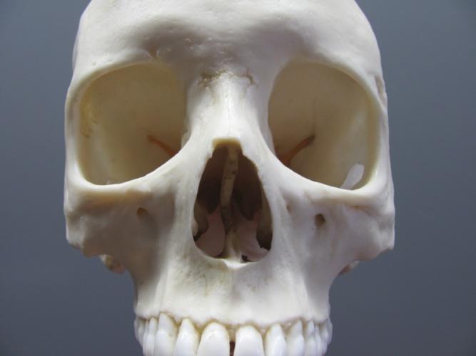 Features of Ancestry: Several morphological traits of the skull were used to determine the European ancestry of this individual.