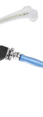 028 5 mm Hex Flexible Screwdriver The preassembled locking mechanism in the nail must be