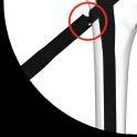 with luer lock to the side-opening cannula and prefill the side-opening cannula with radiographic contrast agent.