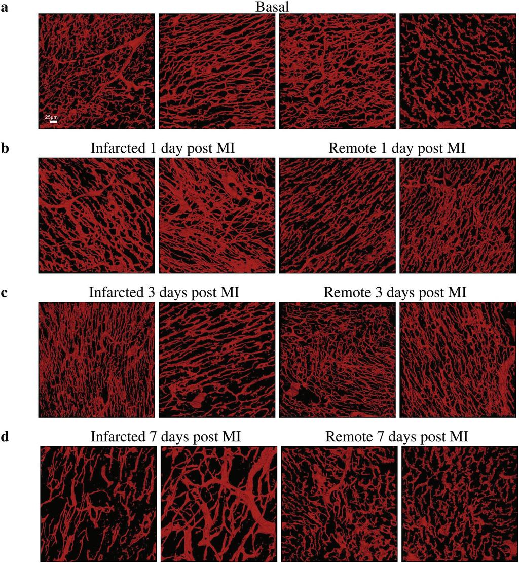 www.nature.com/scientificreports/ Figure 2. Representative 3D reconstructions of the cardiac microvasculature from tissues at different pathophysiological conditions.