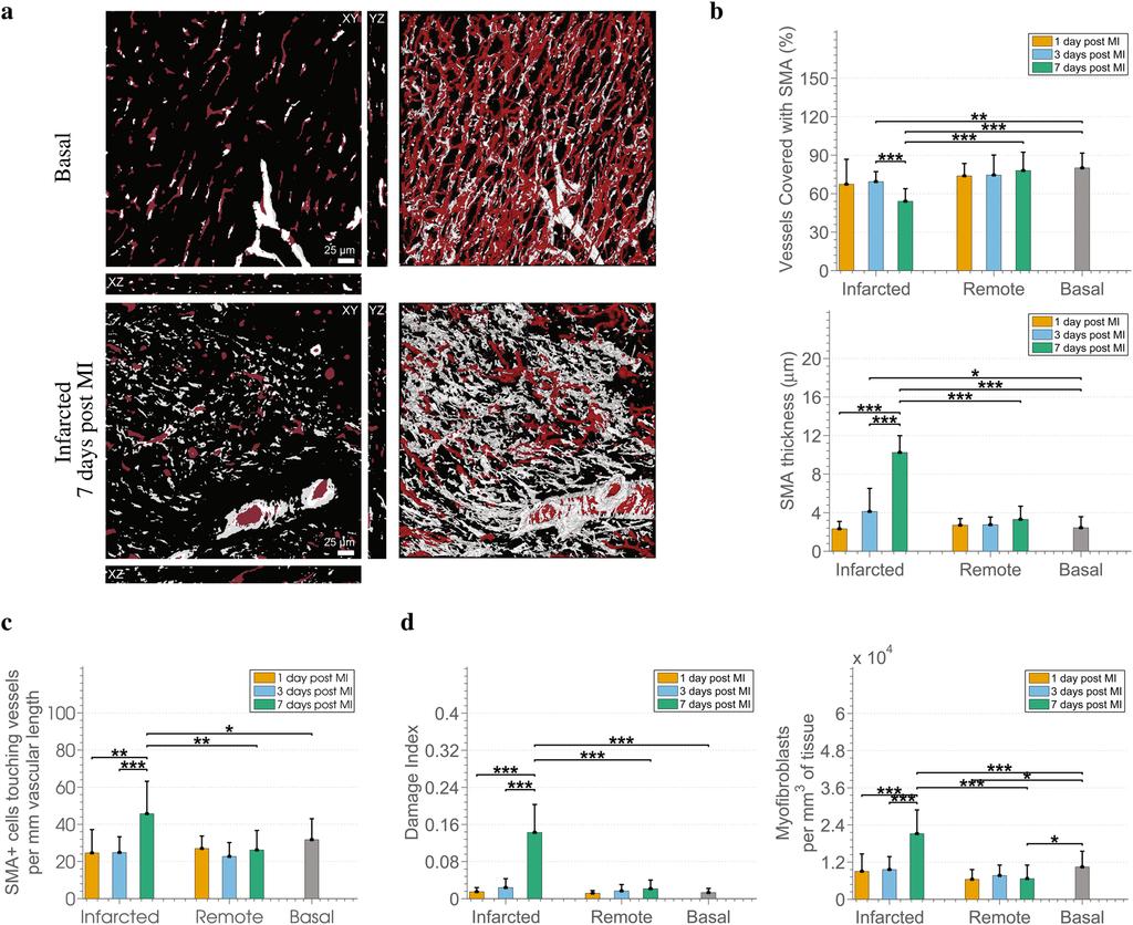www.nature.com/scientificreports/ Figure 5. Changes in SMA+ perivascular cells and myofibroblasts in the aftermath of MI.