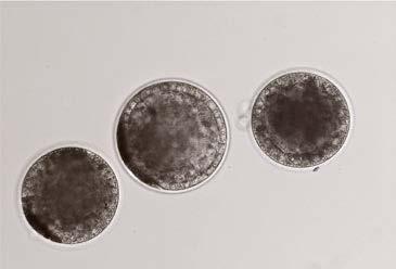 Oocytes can also be aspirated from the small subordinate follicles that may also be present on the ovaries. The oocytes are fertilized in the laboratory by ICSI.