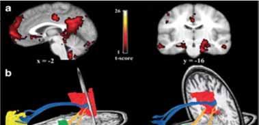 Resting State fmri: Default Mode Network (DMN) Damoiseaux and Greicius Brain Struct Funct 2009, 213:525-533 Summary