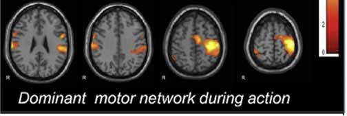 signal fluctuations detectable Persist during sleep, general anesthesia and occurs during non-task activities ie resting state