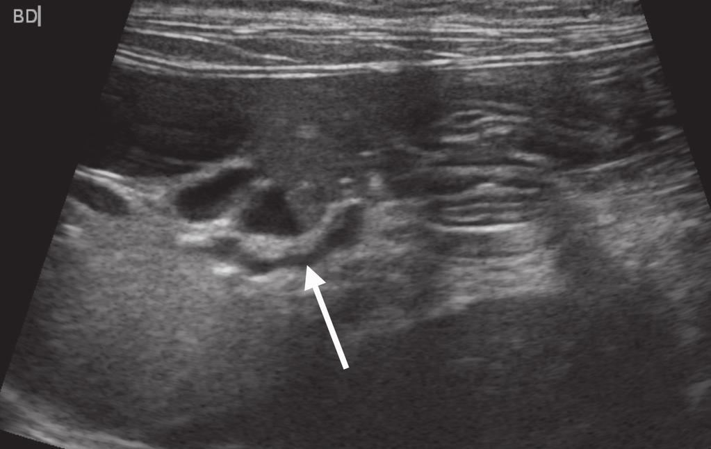 Color Doppler evaluation of the major abdominal vessels near the level of the spleen (); the low-flow small vessels adjacent to the aorta and caudal vena cava can be seen.