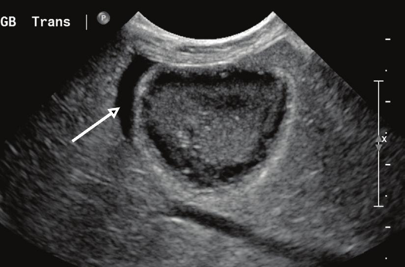 Luminal bnormalities Some echogenic material may be seen within the canine gallbladder (Figure 10).