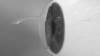 For example, clinical studies confirm that patients see better following LASIK with IntraLase than with the hand-held microkeratome blade.