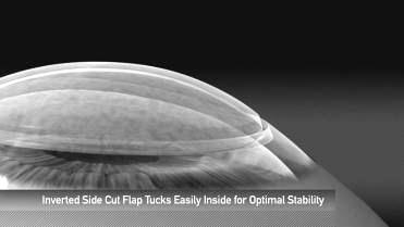 The flap has a larger hinge for better stability New inverted side cut option.