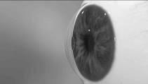 How common is presbyopia?