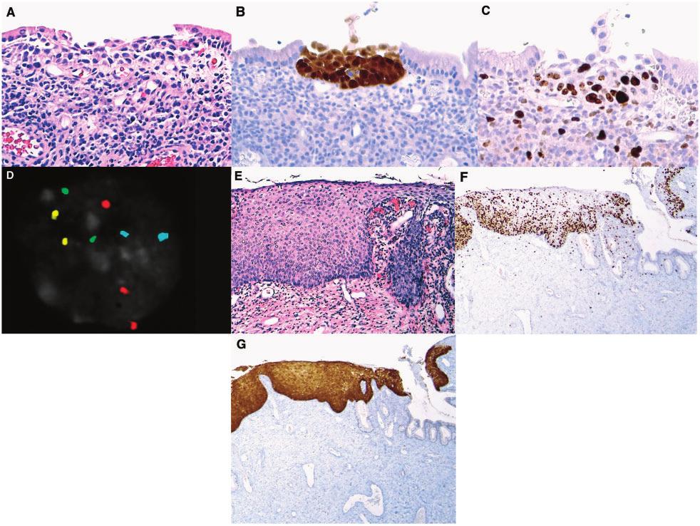 Image 1 Results of testing of several types of cells in patient 1, a 29 year old Caucasian woman.
