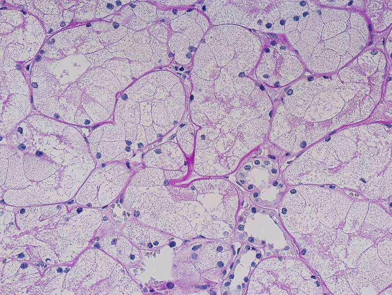 abundant granular cytoplasm. Fig.4.