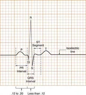 Normal Time Intervals P R Interval (PRI) or P Q Interval (PQI) Seconds QRS Interval Seconds S T Segment Q T Interval Seconds Refractory Periods : Heart CAN beat again but without adequate pumping