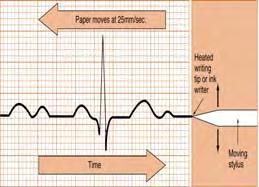 25 26 The Electrocardiogram A single lead cannot: Identify/locate an.