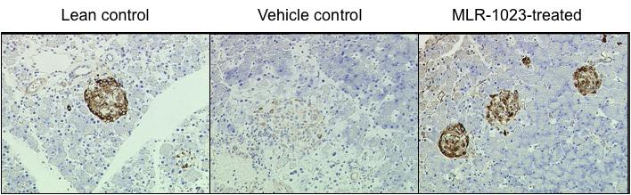 Figure 4. MLR-1023 blocks beta cell degeneration in db/db mice. Eleven week-old mice were treated with either vehicle or MLR-1023 for 8 weeks.
