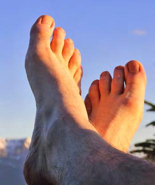 Why the Big Toe? Half of first-time acute flares strike the big toe. Ninety percent of patients will suffer gout of the big toe at some point during the course of the disease.