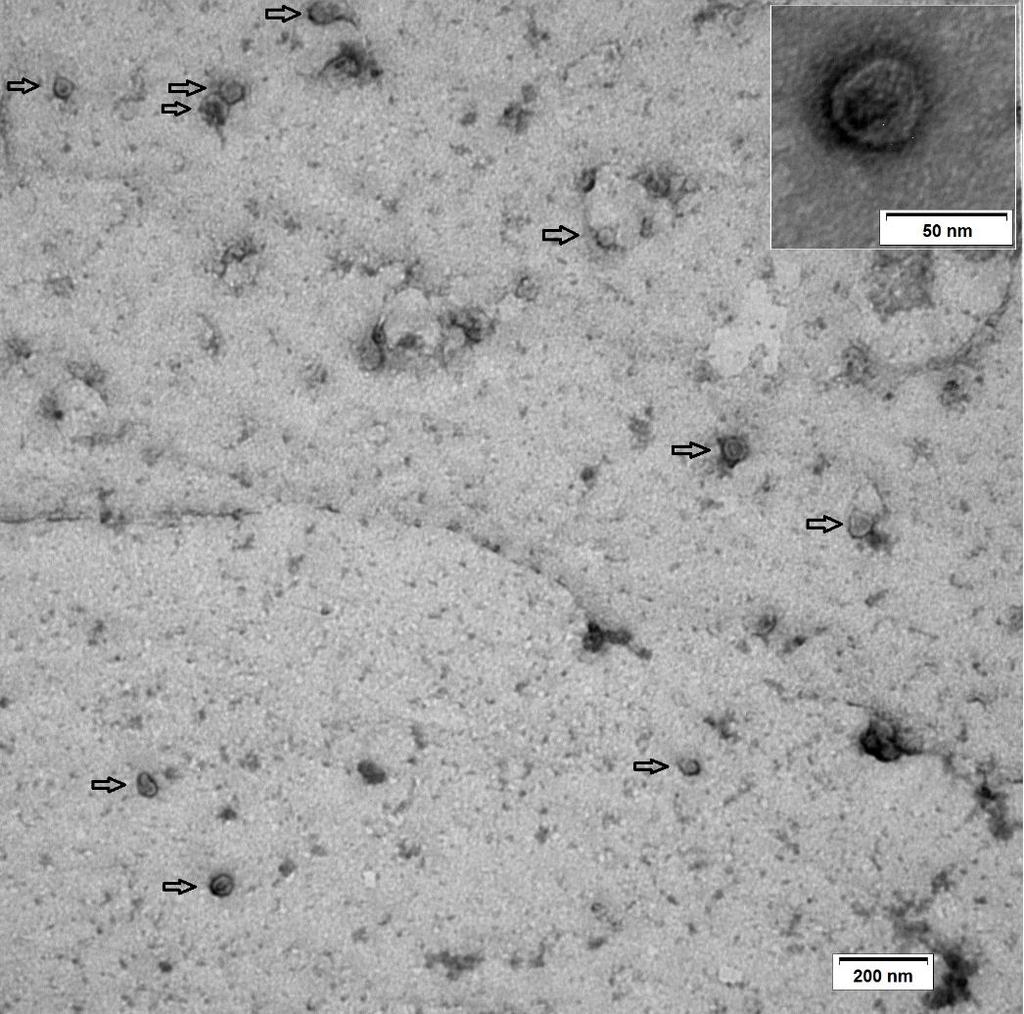 Figure S2 Transmission electron microscopy images showing the extracellular vesicles.