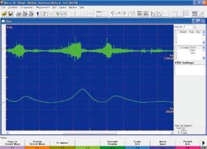 External signals such as pulse wave can be recorded simultaneously. Evoked waveforms with electric, auditory or visual stimulation can be averaged.