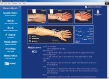 Extensive built-in help The Neuropack Navigator on-screen examination guide shows
