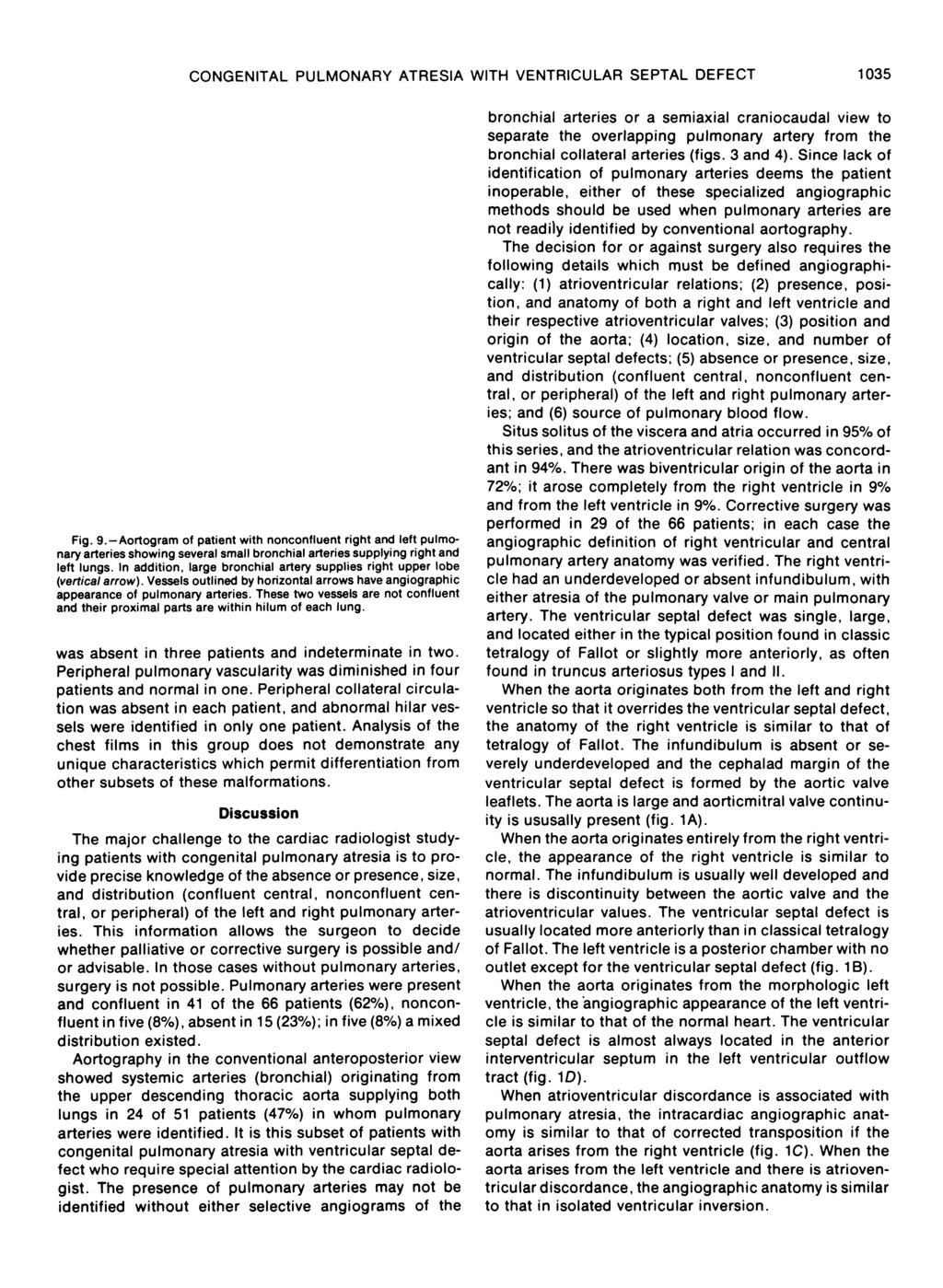 CONGENITAL PULMONARY ATRESIA WITH VENTRICULAR SEPTAL DEFECT 1035 Fig. 9.