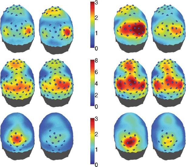 parietal cortex were distinct from the 8.6 Hz responses with foci away from the midline and somewhat right lateralized (not significant).