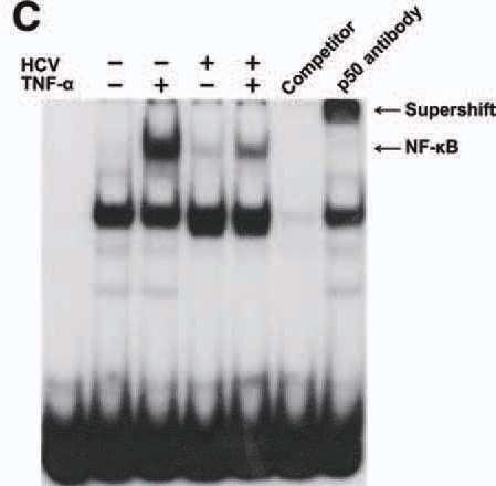 HCV Infection Suppresses TNF- -Induced NF- B Activation SP600125: JNK