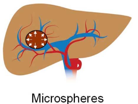 liver tissue supplied by portal circulation 90 Y has a half-life of 64.