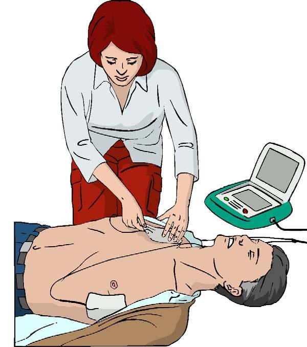 1288 R.W. Koster et al. / Resuscitation 81 (2010) 1277 1292 A lone rescuer should perform CPR for approximately 1 min before going for help.