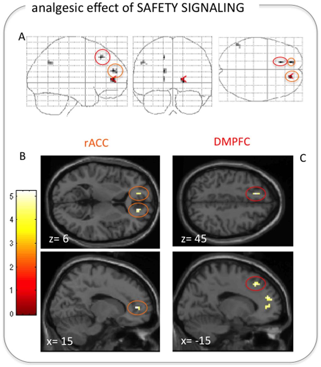 Fig. 4. Bilateral racc and left DMPFC/DLPFC correlated with the analgesic effect of the safety signaling modulation.