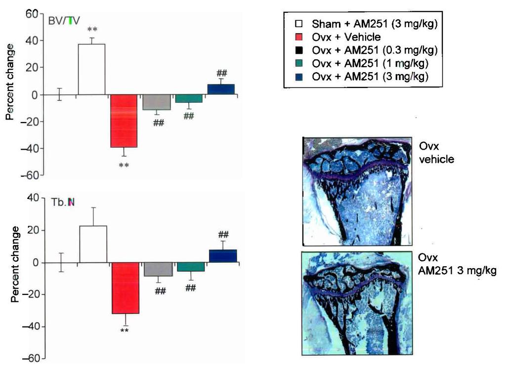 Idris et al. Page 13 Figure 5. Cannabinoid receptor antagonists prevent ovariectomy induce bone loss a.